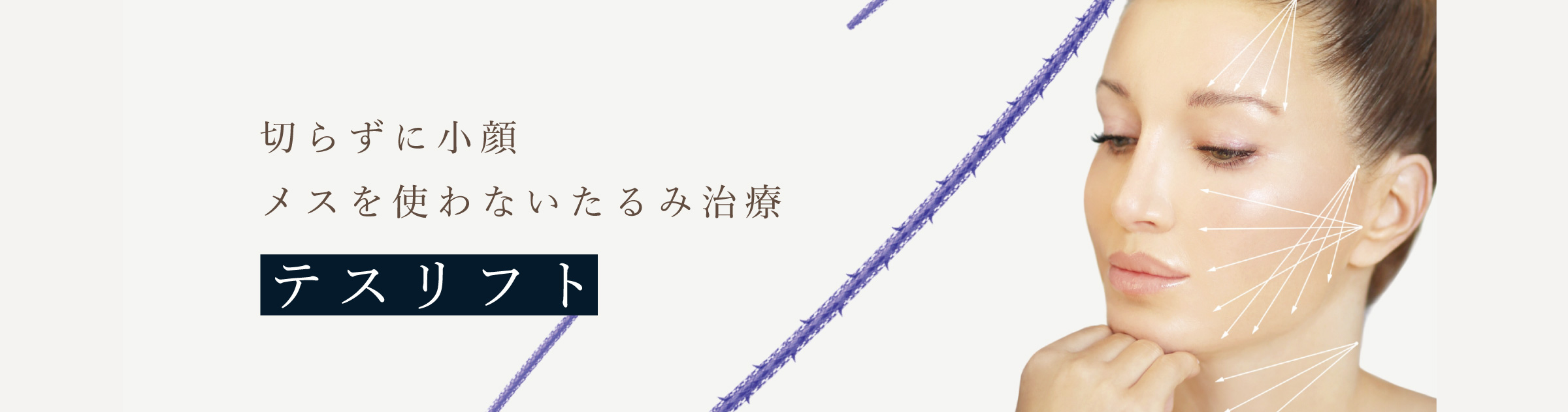 切らずに小顔　メスを使わないたるみ治療　テスリフト