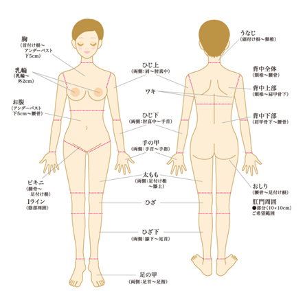 医療レーザー脱毛の適用部位