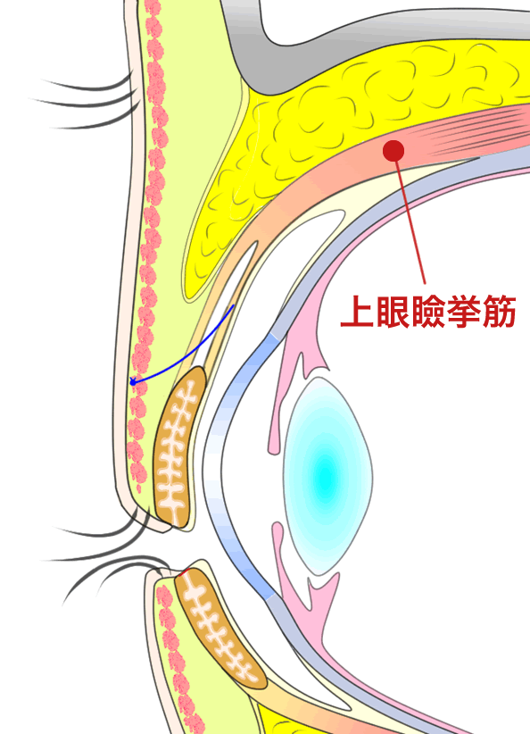 挙筋法