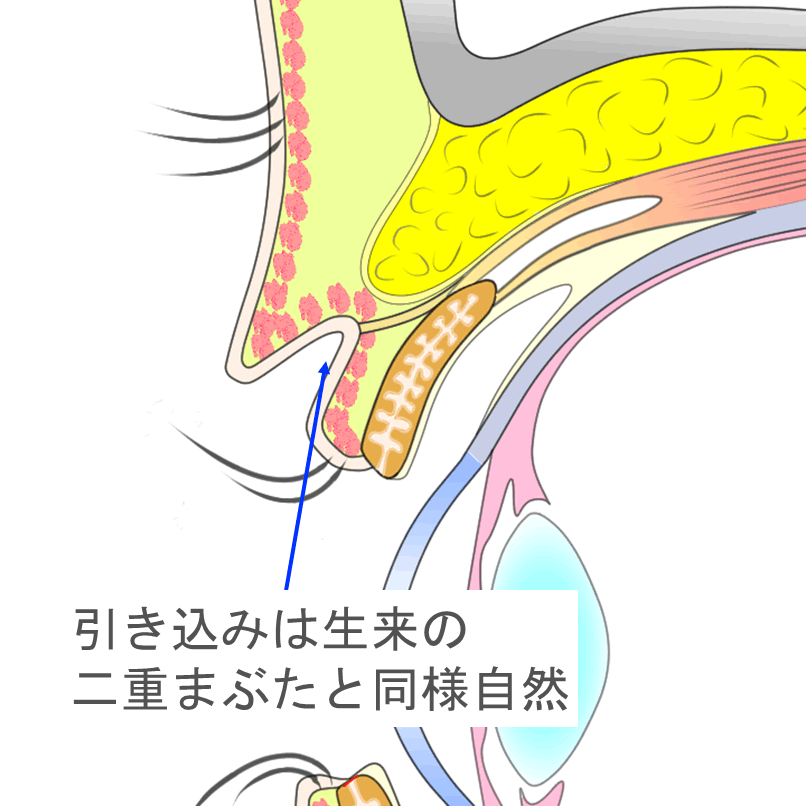 自然な二重まぶたに