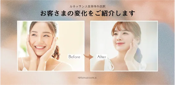 症例写真